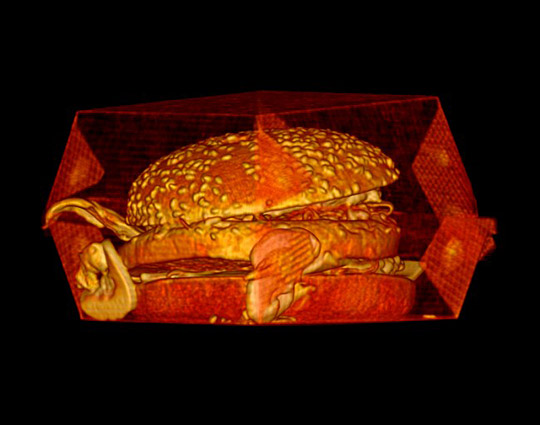 XĔzĝh